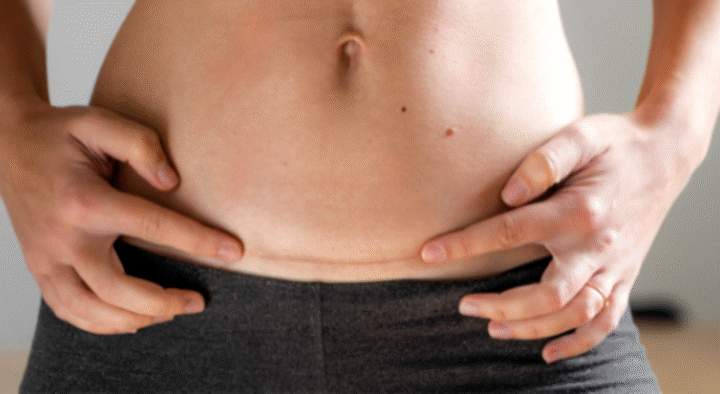 Aktiveringsøvelser for bækkenbund og mave, efter kejsersnit?​​​​​​​